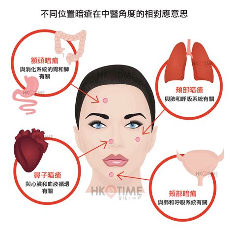 上唇 暗瘡|【暗瘡位置】不同代表什麼？中醫教如何處理及預防